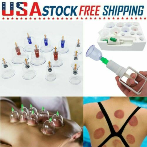 12 Cups Set Medical Chinese Body Vacuum Cupping Healthy Suction Therapy Massage